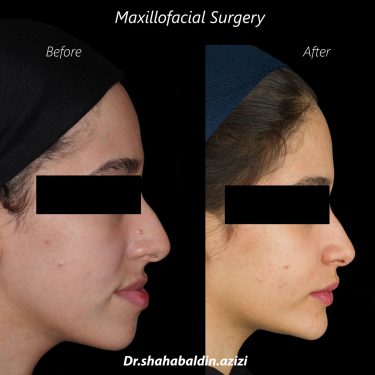 نمونه کار دکتر شهاب الدین عزیزی