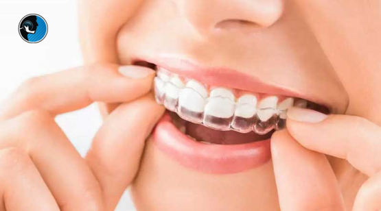 استفاده از نایت گارد