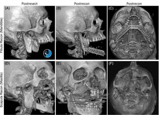 عکس سه بعدی فک