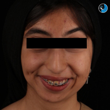 جراحی فک در بیماران با ترومای مادرزادی