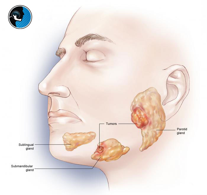 ضایعات پاتولوژیک فک