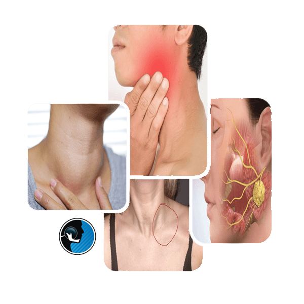 جراحی تومور سر و گردن