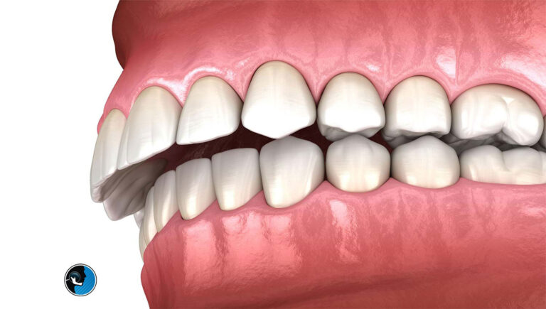 دیپ بایت چیست