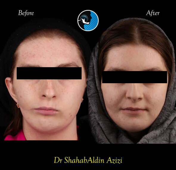 جراحی فک و صورت در تهران