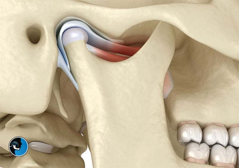 تریسموس یا قفل شدن فک