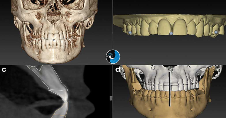 عکس cbct از فک