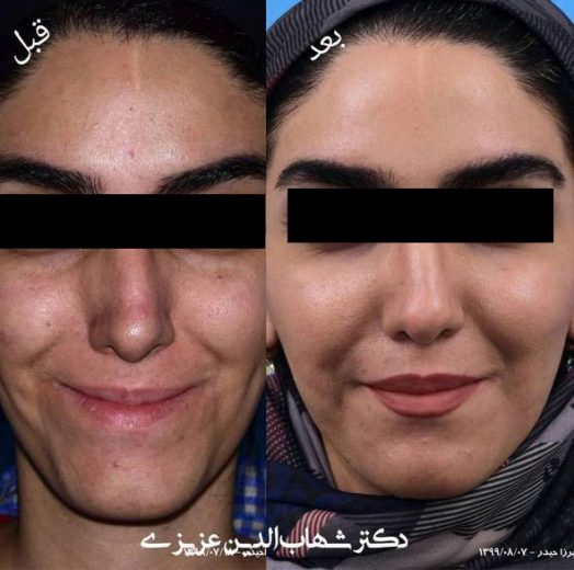 عکس جراحی فک به روش دیجیتال