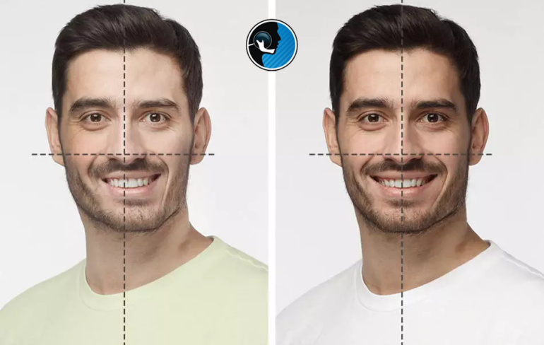 اصلاح انحراف فک