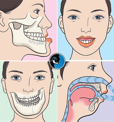 ناهنجاری فک