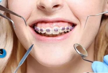 جراحی فک و ارتودنسی با هم