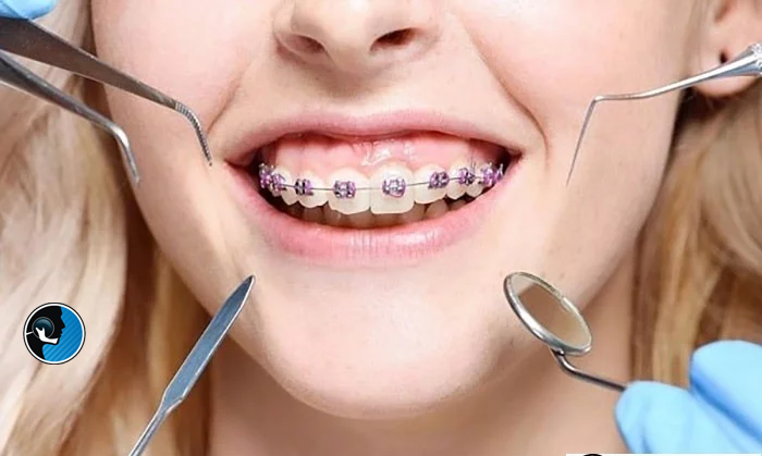 جراحی فک و ارتودنسی با هم