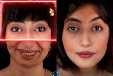 جراحی فک و تناسب صورت