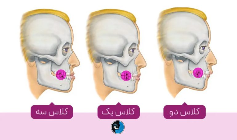 انواع ناهنجاری فک