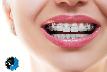 ارتودنسی و‌ جراحی فک ‌همزمان در تهران