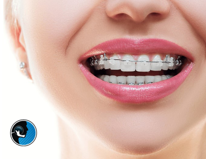 ارتودنسی و‌ جراحی فک ‌همزمان در تهران