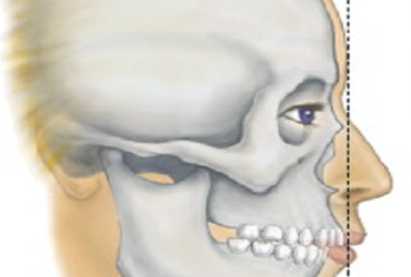 کوچکی فک پایین
