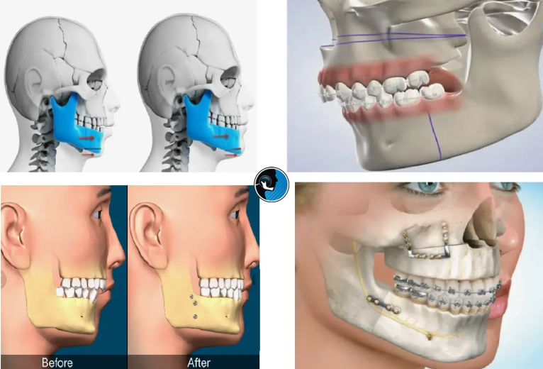 تفاوت ارتودنسی و جراحی فک