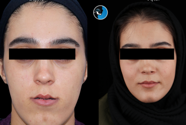 جراحی فک چیست؟