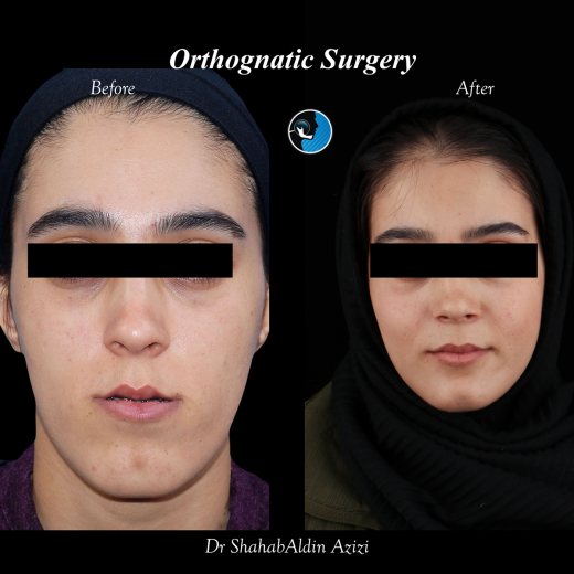 جراحی فک چیست؟