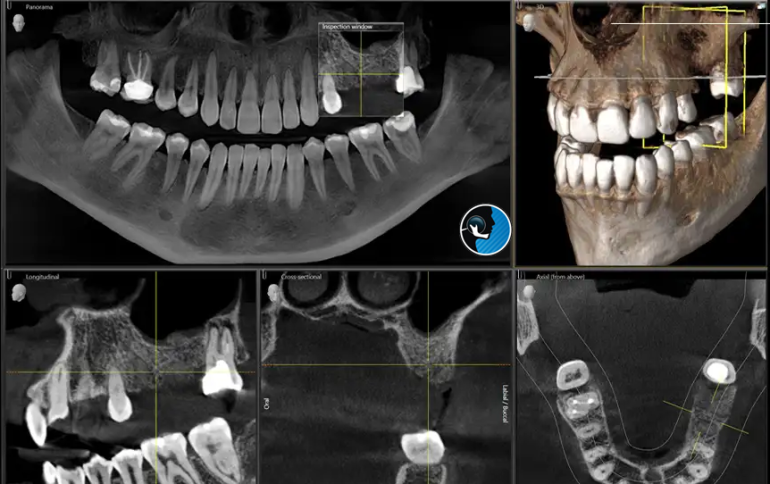 نقش فناوری تصویربرداری پیشرفته (CT، CBCT) در برنامه‌ریزی جراحی فک