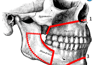 آیا جراحی فک درد دارد؟