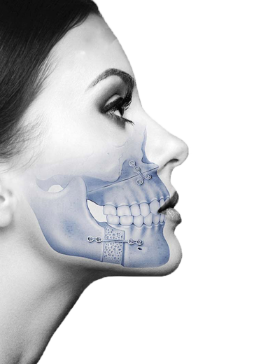 نمونه جراحی فک